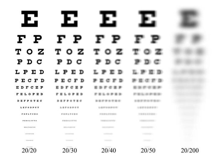 Prescription eyeglass eye glasses chart 20 understanding vision sighted near astigmatism myopia far means